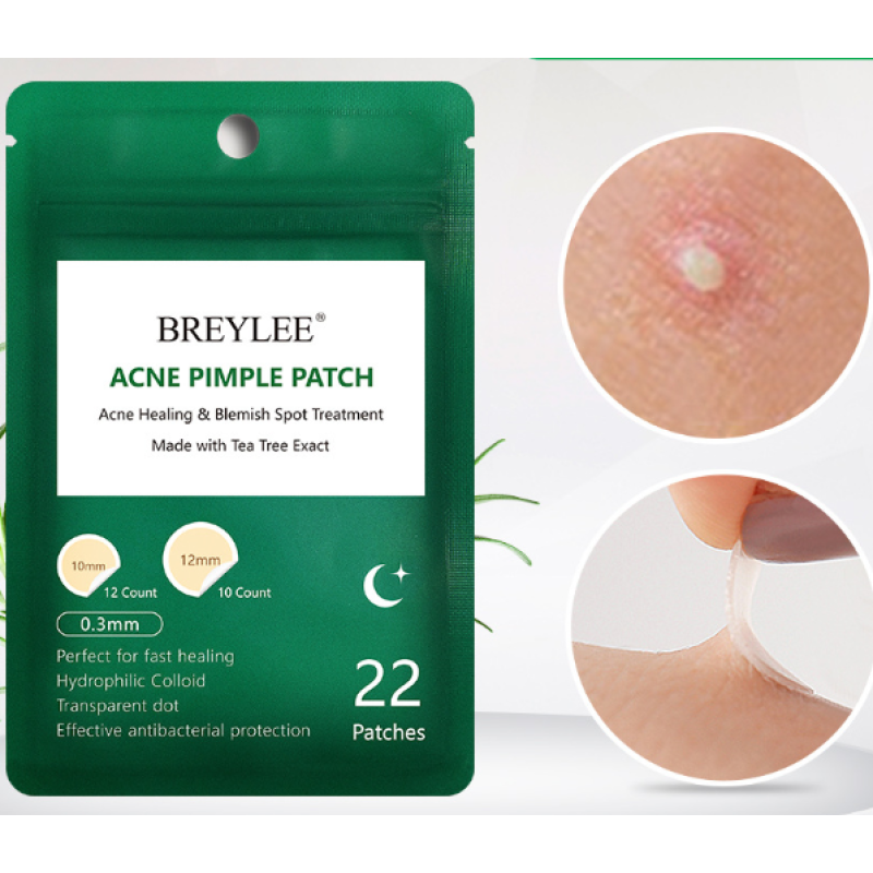 Acne stickers, night acne stickers, fade acne marks — photo 1 of 5