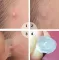 Acne stickers, night acne stickers, fade acne marks — photo 4 of 5