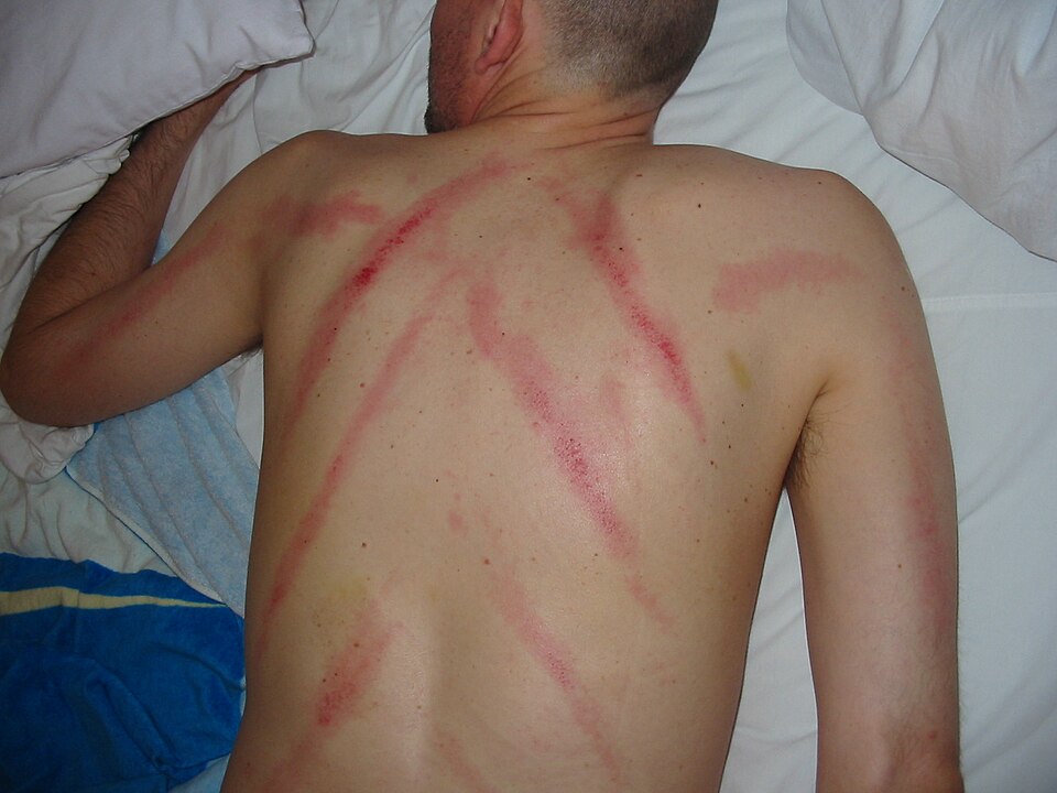 A flat massage tool being drawn across the skin of a back